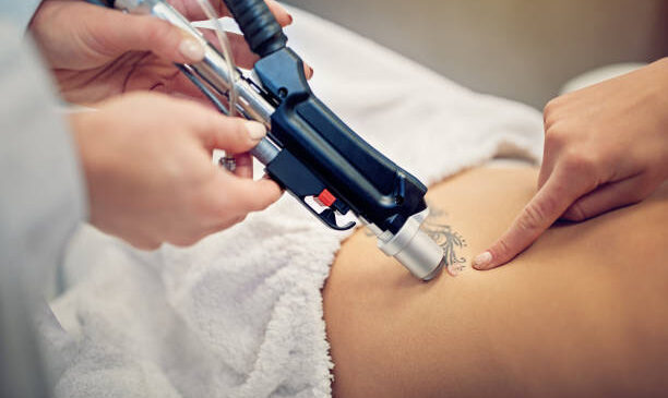 The Role of Ink Colors in Tattoo Removal Effectiveness